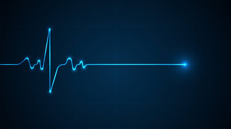 Modafinil and Irregular Heartbeat